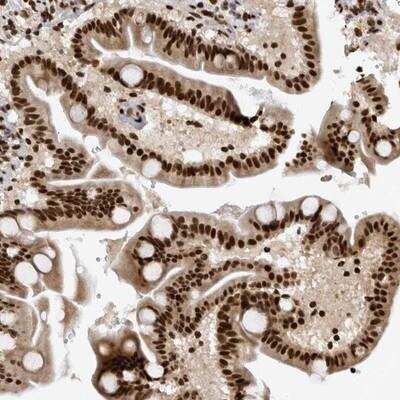 Immunohistochemistry-Paraffin: ZSCAN2 Antibody [NBP1-82169]
