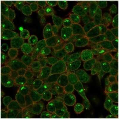 Immunocytochemistry/ Immunofluorescence: ZSCAN2 Antibody (PCRP-ZSCAN2-1F8) [NBP3-13748]