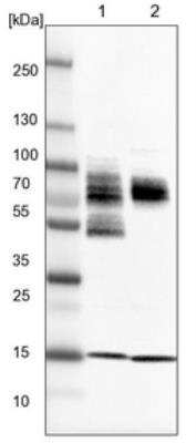 Western Blot: ZSCAN2 Antibody [NBP1-82169]