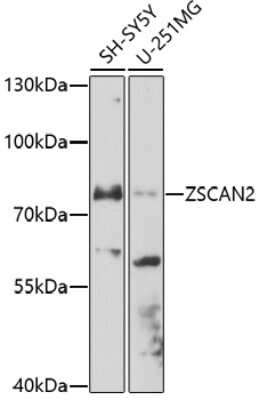 Western Blot: ZSCAN2 AntibodyAzide and BSA Free [NBP2-93105]