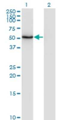 Western Blot: ZSCAN21/ZFP38 Antibody (4B11) [H00007589-M08]