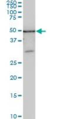 Western Blot: ZSCAN21/ZFP38 Antibody (4B3) [H00007589-M09]