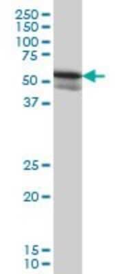 Western Blot: ZSCAN21/ZFP38 Antibody (4B3) [H00007589-M09]