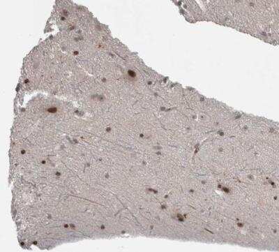 Immunohistochemistry-Paraffin: ZSCAN21/ZFP38 Antibody [NBP1-84182]