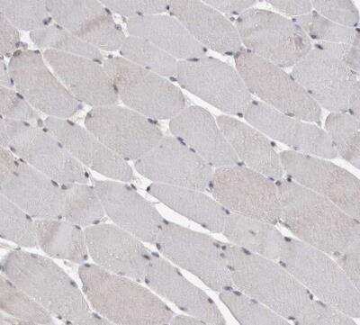 Immunohistochemistry-Paraffin: ZSCAN21/ZFP38 Antibody [NBP1-84182]