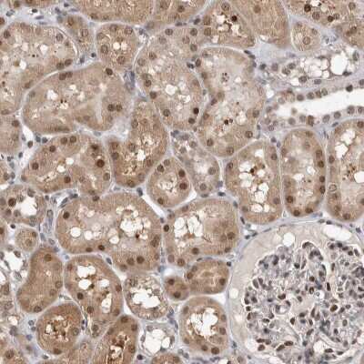 Immunohistochemistry-Paraffin: ZSCAN21/ZFP38 Antibody [NBP1-84182]