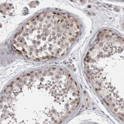 Immunohistochemistry-Paraffin: ZSCAN21/ZFP38 Antibody [NBP1-84182]