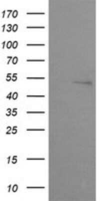 Western Blot: ZSCAN21/ZFP38 Antibody (OTI2E5)Azide and BSA Free [NBP2-74956]