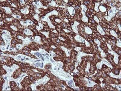 Immunohistochemistry: ZSCAN21/ZFP38 Antibody (OTI2E5) [NBP2-45443]