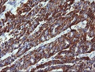 Immunohistochemistry: ZSCAN21/ZFP38 Antibody (OTI2E5) [NBP2-45443]