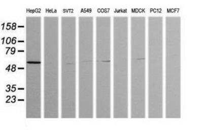 Western Blot: ZSCAN21/ZFP38 Antibody (OTI2E5) [NBP2-45443]