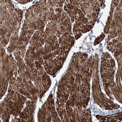 Immunohistochemistry-Paraffin: ZSCAN23 Antibody [NBP1-90578]