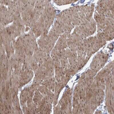 Immunohistochemistry-Paraffin: ZSCAN23 Antibody [NBP2-38274]