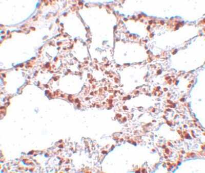Immunohistochemistry-Paraffin: ZSCAN4 Antibody - BSA Free [NBP1-77120]