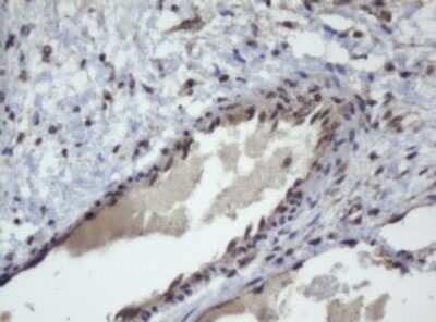 Immunohistochemistry: ZSCAN4 Antibody (OTI1A6) - Azide and BSA Free [NBP2-74957]