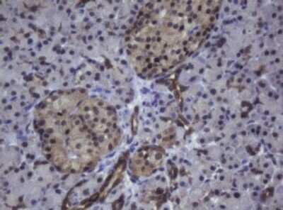 Immunohistochemistry: ZSCAN4 Antibody (OTI1A6) - Azide and BSA Free [NBP2-74957]