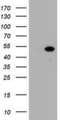 Western Blot: ZSCAN4 Antibody (OTI1A6)Azide and BSA Free [NBP2-74957]