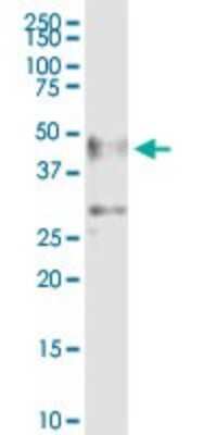 Western Blot: ZSCAN4 Antibody [H00201516-B01P]