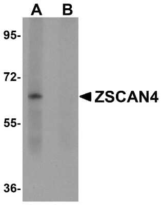 Western Blot: ZSCAN4 AntibodyBSA Free [NBP1-77120]