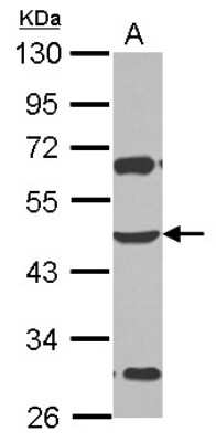 Western Blot: ZSCAN4 Antibody [NBP2-21054]