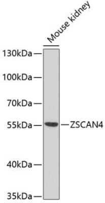 Western Blot: ZSCAN4 AntibodyBSA Free [NBP3-05600]