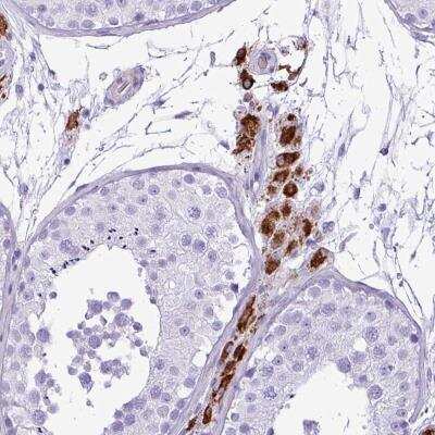 Immunohistochemistry: ZSCAN5 Antibody [NBP2-46665]