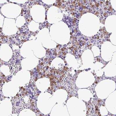 Immunohistochemistry: ZSCAN5 Antibody [NBP2-46692]