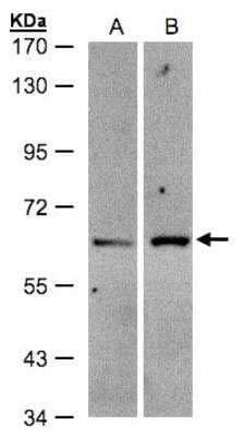 Western Blot: ZSCAN5 Antibody [NBP1-32400]