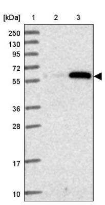 Western Blot: ZSCAN5 Antibody [NBP2-46665]