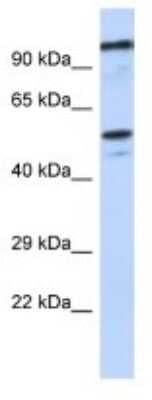 Western Blot: ZSCAN5 Antibody [NBP3-10384]