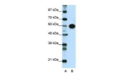 Western Blot: ZSCAN5 Antibody [NBP3-10385]