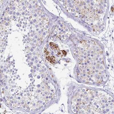 Immunohistochemistry: ZSCAN5B Antibody [NBP2-37974]