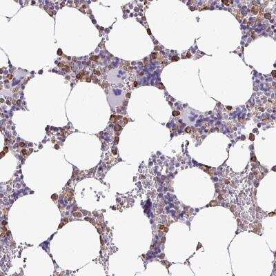 Immunohistochemistry: ZSCAN5 Antibody [NBP2-46728]