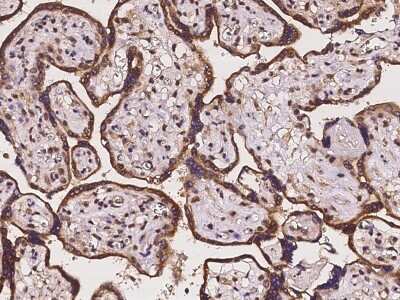 Immunohistochemistry-Paraffin: ZSCAN5C Antibody [NBP2-98124]