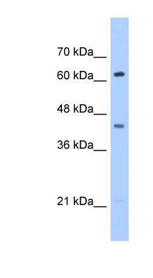 Western Blot: ZSCAN5D Antibody [NBP1-91322]