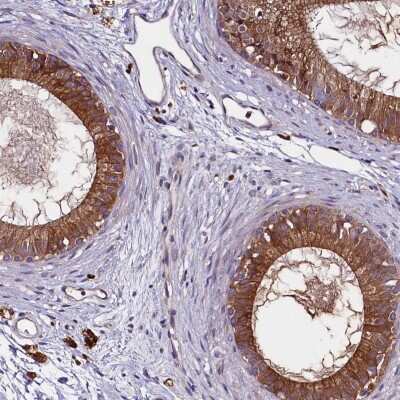 Immunohistochemistry-Paraffin: ZSWIM1 Antibody [NBP2-13606]