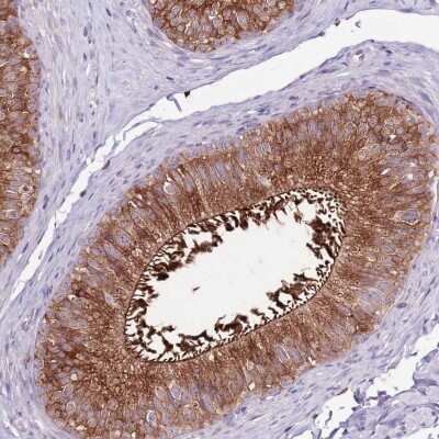 Immunohistochemistry-Paraffin: ZSWIM1 Antibody [NBP2-13607]