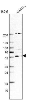 Western Blot: ZSWIM1 Antibody [NBP2-13606]