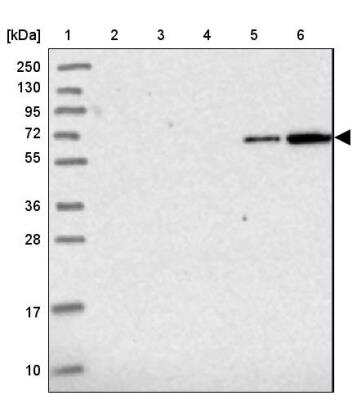 Western Blot: ZSWIM1 Antibody [NBP2-13607]