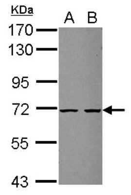 Western Blot: ZSWIM2 Antibody [NBP2-21055]