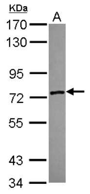 Western Blot: ZSWIM2 Antibody [NBP2-21056]