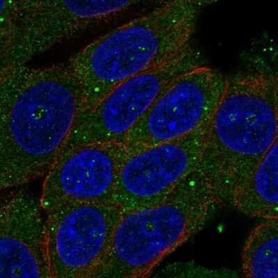 Immunocytochemistry/ Immunofluorescence: ZSWIM3 Antibody [NBP2-56599]