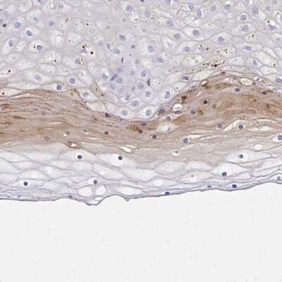 Immunohistochemistry: ZSWIM3 Antibody [NBP2-31609]