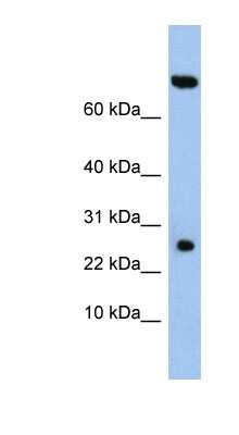 Western Blot: ZSWIM3 Antibody [NBP1-56683]