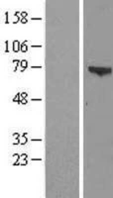 Western Blot: ZSWIM3 Overexpression Lysate [NBL1-18275]