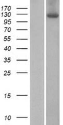 Western Blot: ZSWIM4 Overexpression Lysate [NBP2-06387]