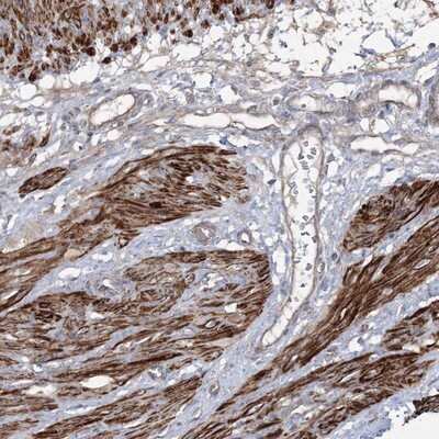 Immunohistochemistry-Paraffin: ZSWIM6 Antibody [NBP1-93584]