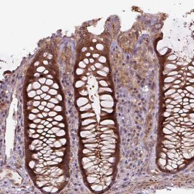 Immunohistochemistry-Paraffin: ZSWIM7 Antibody [NBP2-30937]