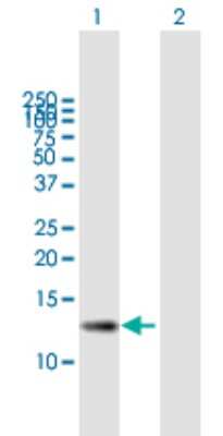 Western Blot: ZSWIM7 Antibody [H00125150-B01P]