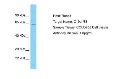 Western Blot: ZSWIM9 Antibody [NBP2-83920]